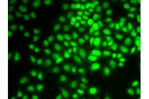 Immunofluorescence analysis of HeLa cells using CCNG1 antibody (ABIN6290270). (Cyclin G1 抗体)