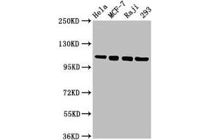 Western Blot Positive WB detected in: Hela whole cell lysate, MCF-7 whole cell lysate, Raji whole cell lysate, 293 whole cell lysate All lanes: MCM2 antibody at 4. (MCM2 抗体  (AA 2-904))
