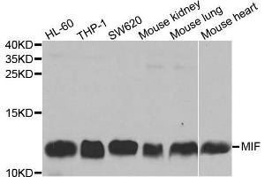 Western blot analysis of extracts of various cell lines, using MIF antibody. (MIF 抗体  (AA 1-115))