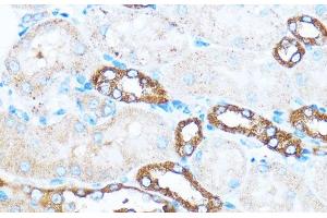 Immunohistochemistry of paraffin-embedded Mouse kidney using PIK3CA Polyclonal Antibody at dilution of 1:100 (40x lens). (PIK3CA 抗体)