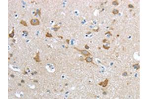 The image on the left is immunohistochemistry of paraffin-embedded Human brain tissue using ABIN7190915(HCN4 Antibody) at dilution 1/20, on the right is treated with synthetic peptide. (HCN4 抗体)