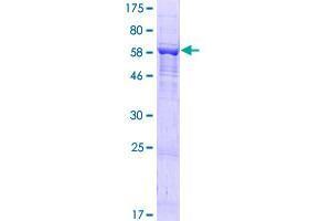 DENND1B Protein (AA 1-396) (GST tag)