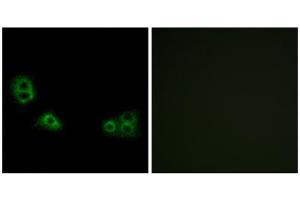 Immunofluorescence analysis of MCF-7 cells, using TMEM185A antibody. (TMEM185A 抗体  (C-Term))