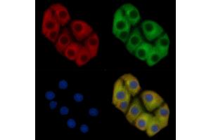 MYH9 Mouse Monoclonal Antibody staining Hela cells by IF/ICC. (Myosin 9 抗体  (C-Term))