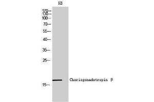 Western Blotting (WB) image for anti-Chorionic Gonadotropin, beta Polypeptide (CGB) (C-Term) antibody (ABIN3183911) (CGB 抗体  (C-Term))