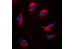 Immunofluorescent analysis of SOCS1 staining in MCF7 cells. (SOCS1 抗体  (Center))