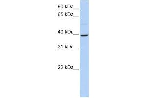 WB Suggested Anti-KLF12 Antibody Titration:  0. (KLF12 抗体  (N-Term))