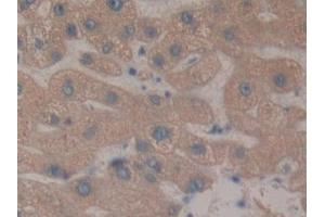 Detection of RNPEP in Human Liver Tissue using Polyclonal Antibody to Aminopeptidase B (RNPEP) (RNPEP 抗体  (AA 388-616))
