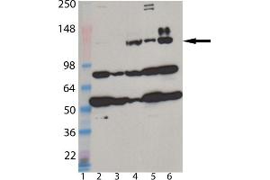 Western blot analysis of MDA5 monoclonal antibody (1B6) : Lane 1: MW marker, Lane 2: HeLa, Lane 3: A431, Lane 4: L929, Lane 5: 3T3, Lane 6: Jurkat cell lysate. (IFIH1 抗体  (AA 78-555))