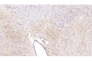 Detection of APC in Rat Cerebrum Tissue using Polyclonal Antibody to Adenomatosis Polyposis Coli Protein (APC) (APC 抗体  (AA 2634-2842))