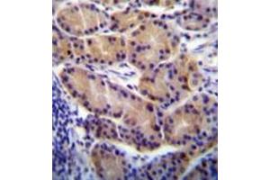 Immunohistochemistry (Paraffin-embedded Sections) (IHC (p)) image for anti-Cytochrome P450, Family 2, Subfamily S, Polypeptide 1 (CYP2S1) (AA 406-436), (C-Term) antibody (ABIN951784)
