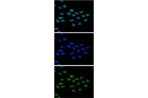 Immunofluorescence Microscopy of anti-JMJD2b antibody Immunofluorescence Microscopy results of Rabbit anti-JMJD2b antibody. (KDM4B 抗体  (Internal Region))