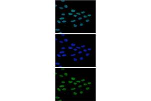 Immunofluorescence Microscopy of anti-JMJD2b antibody Immunofluorescence Microscopy results of Rabbit anti-JMJD2b antibody.