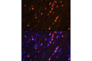 Immunofluorescence analysis of mouse brain using S100B Rabbit mAb (ABIN7270131) at dilution of 1:100 (40x lens). (S100B 抗体)
