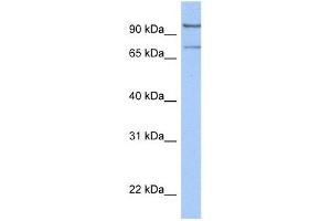 LCMT2 antibody used at 1 ug/ml to detect target protein. (LCMT2 抗体  (C-Term))