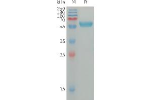 SDS-PAGE (SDS) image for Immunoglobulin Superfamily, Member 11 (IGSF11) (AA 23-241) protein (Fc Tag) (ABIN7538327)