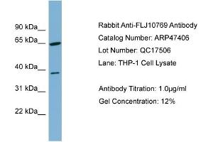 WB Suggested Anti-FLJ10769  Antibody Titration: 0. (FLJ10769 (Middle Region) 抗体)