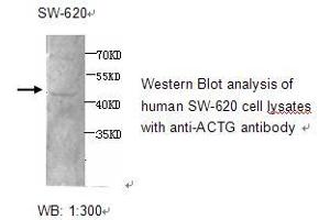 Image no. 1 for anti-Actin, gamma 1 (ACTG1) antibody (ABIN790765) (Actin, gamma 1 抗体)