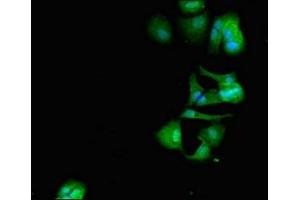 Immunofluorescent analysis of MCF-7 cells using ABIN7150470 at dilution of 1:100 and Alexa Fluor 488-congugated AffiniPure Goat Anti-Rabbit IgG(H+L) (CRCP 抗体  (AA 1-115))