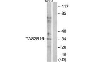 Western blot analysis of extracts from MCF-7 cells, using TAS2R16 Antibody.