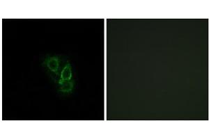 Immunofluorescence analysis of A549 cells, using RAD antibody. (RRAD 抗体  (Internal Region))