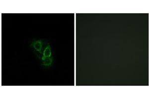 Immunofluorescence analysis of A549 cells, using RAD antibody.