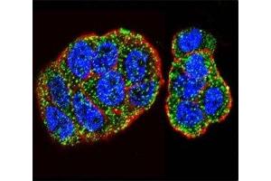 Confocal immunofluorescent analysis of KRAS antibody with WiDr cells followed by Alexa Fluor 488-conjugated goat anti-rabbit lgG (green). (K-RAS 抗体  (AA 146-174))
