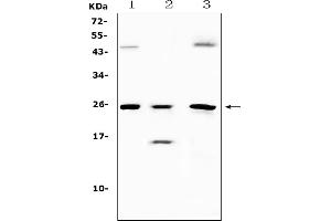 Western blot analysis of TIMP4 using anti-TIMP4 antibody (ABIN5518879). (TIMP4 抗体  (AA 174-224))