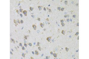 Immunohistochemistry of paraffin-embedded Mouse brain using CDA Polyclonal Antibody at dilution of 1:100 (40x lens).