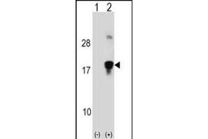 Western blot analysis of HMGN3 (arrow) using rabbit polyclonal HMGN3 Antibody (N-term) (ABIN1538803 and ABIN2848496). (HMGN3 抗体  (N-Term))