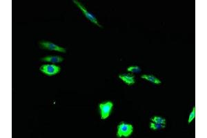 Immunofluorescent analysis of HepG2 cells using ABIN7171854 at dilution of 1:100 and Alexa Fluor 488-congugated AffiniPure Goat Anti-Rabbit IgG(H+L) (Tetraspanin 15 抗体  (AA 115-235))