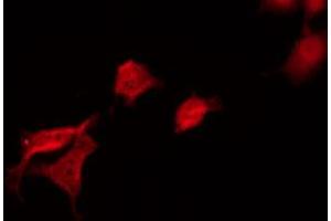 ABIN6269100 staining 293 by IF/ICC. (FYN 抗体  (C-Term))