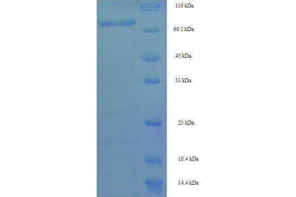 DCAF4 Protein (AA 1-495, full length) (His-SUMO Tag)