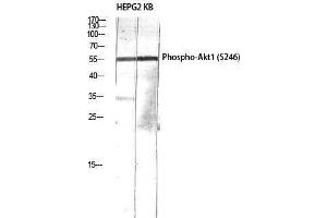 Western Blotting (WB) image for anti-V-Akt Murine Thymoma Viral Oncogene Homolog 1 (AKT1) (pSer246) antibody (ABIN3179383) (AKT1 抗体  (pSer246))