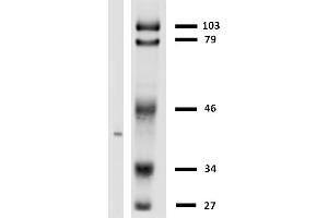Western blotting analysis of HLA-G in LCL-HLA-G transfectants using anti-HLA-G (MEM-G/2). (HLAG 抗体)