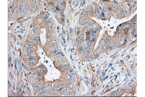 Immunohistochemical staining of paraffin-embedded Human pancreas tissue using anti-SNX9 mouse monoclonal antibody.