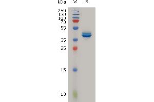 SDS-PAGE (SDS) image for Chemokine (C-C Motif) Ligand 2 (CCL2) (AA 24-99) protein (Fc Tag) (ABIN6964235)