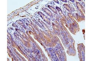 IHC analysis of Filamin B/FLNB using anti-Filamin B/FLNB antibody (ABIN7601607). (FLNB 抗体  (AA 397-701))