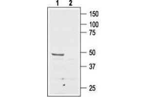 Angiotensin II Type 2 Receptor 抗体  (Extracellular, N-Term)