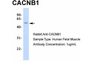 Host:  Rabbit  Target Name:  CACNB1  Sample Type:  Human Fetal Muscle  Antibody Dilution:  1.