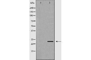 Western blot analysis of extracts of mouse livertissue lysate, using NEUROG3 antibody.