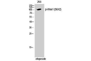 Western Blotting (WB) image for anti-WEE1 Homolog (S. Pombe) (WEE1) (pSer642) antibody (ABIN3182286) (WEE1 抗体  (pSer642))