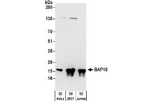 Western Blotting (WB) image for anti-Chromosome 17 Open Reading Frame 49 (C17orf49) (AA 122-172) antibody (ABIN7450019)