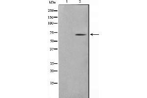 Western blot analysis on NIH-3T3 cell lysate using TGFR2 Antibody,The lane on the left is treated with the antigen-specific peptide. (TGFBR2 抗体  (Internal Region))