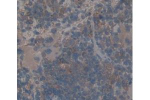 Used in DAB staining on fromalin fixed paraffin- embedded spleen tissue (DTNBP1 抗体  (AA 110-305))