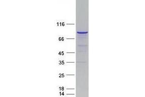 Validation with Western Blot
