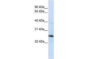 WB Suggested Anti-RTN1 Antibody Titration:  0. (Reticulon 1 抗体  (Middle Region))