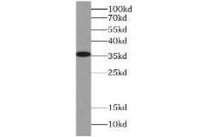 HeLa cells were subjected to SDS PAGE followed by western blot with (LDHA antibody) at dilution of 1:500. (Lactate Dehydrogenase A 抗体)