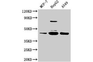 Western Blot Positive WB detected in: MCF-7 whole cell lysate, HepG2 whole cell lysate, A549 whole cell lysate All lanes: SERPINB1 antibody at 2 μg/mL Secondary Goat polyclonal to rabbit IgG at 1/50000 dilution Predicted band size: 43, 27 kDa Observed band size: 43 kDa (SERPINB1 抗体  (AA 1-379))