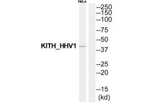 Western blot analysis of extracts from HeLa cells, using Thymidine kinase antibody. (TK1 抗体  (Internal Region))